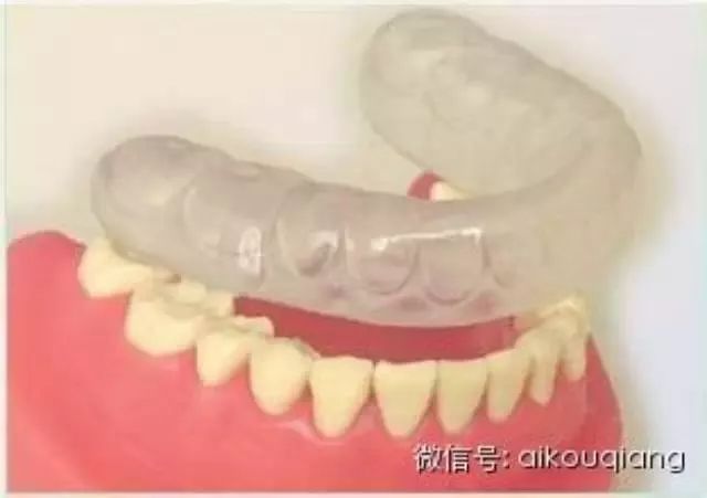 一圖帶你瞭解磨牙症
